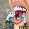 在深圳成年人和青少年的牙齿矫正有什么区别？