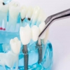 在深圳牙周炎可以种植牙齿吗？