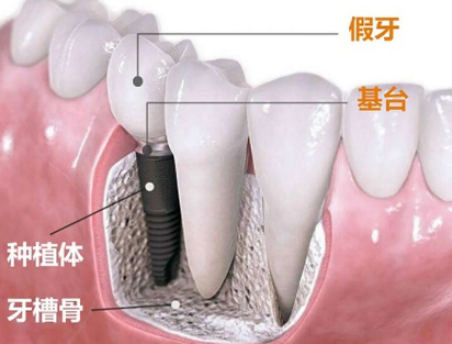 深圳维港口腔连锁