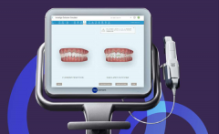 iTero口内数字化扫描应用——隐适美隐形矫正医师陈何熙