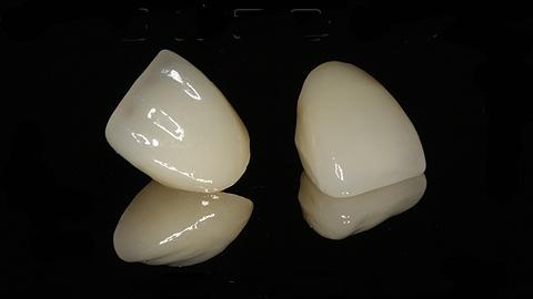 珠海烤瓷牙價格