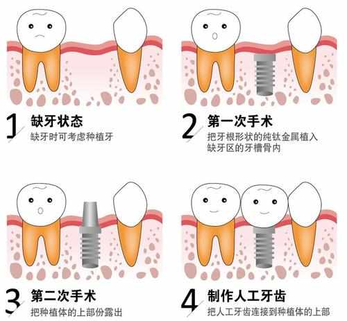 珠海種牙醫院邊度好