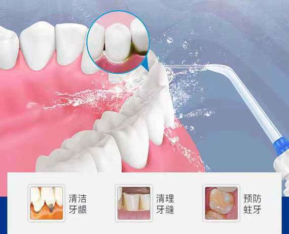 洗牙不是美白牙