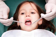 孩子牙齿不齐应换牙前还是换牙后矫正