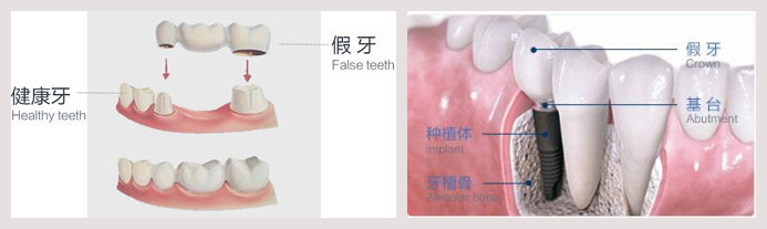 深圳维港口腔连锁