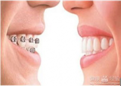 在深圳成年以后千万别整牙？