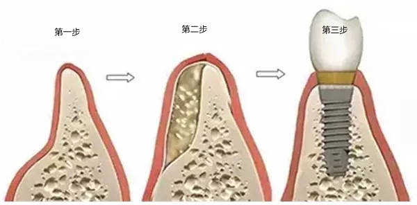 深圳维港口腔连锁