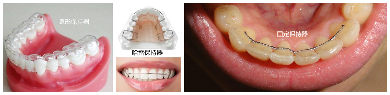 深圳维港口腔连锁提供